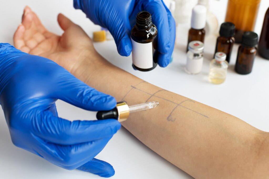 Tratamiento dermatitis atópica